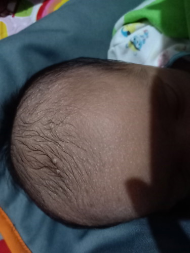 Bayi 13 hari