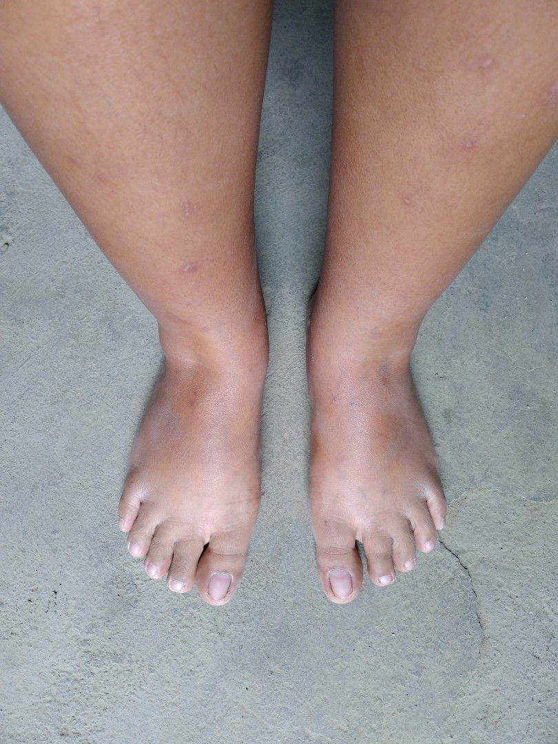 Paang parang minamanas... ?