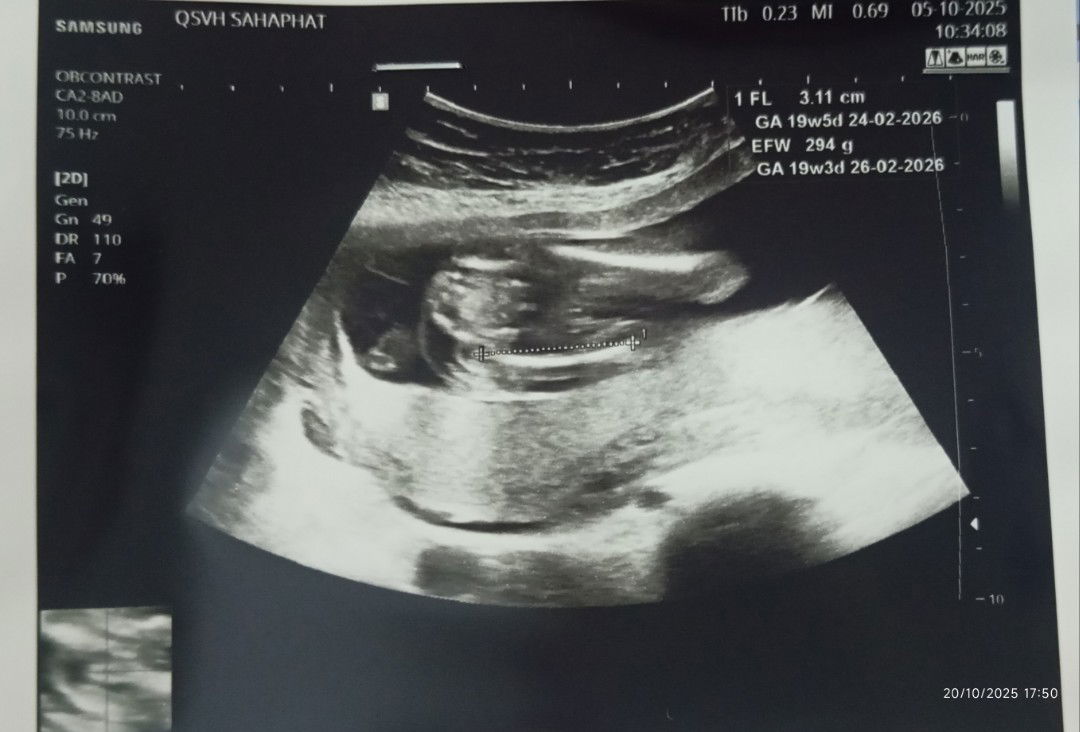 Thipnapa Thodsa profile icon