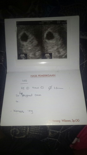 kehamilan