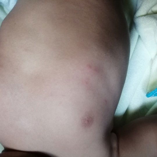 Bintik Merah Di Badan