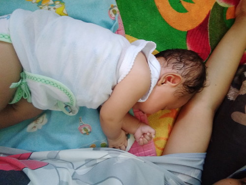 kepala bayi panjang