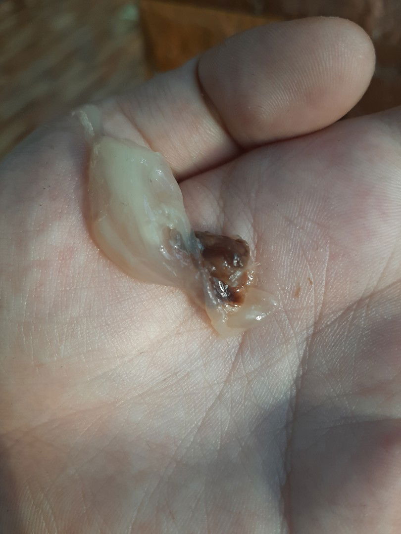 มูกออกแบบนี้กี่วันคลอดคะ