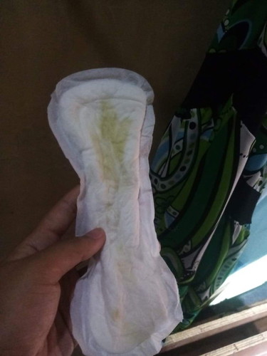 panubigan po ba ito or yellow discharge lang