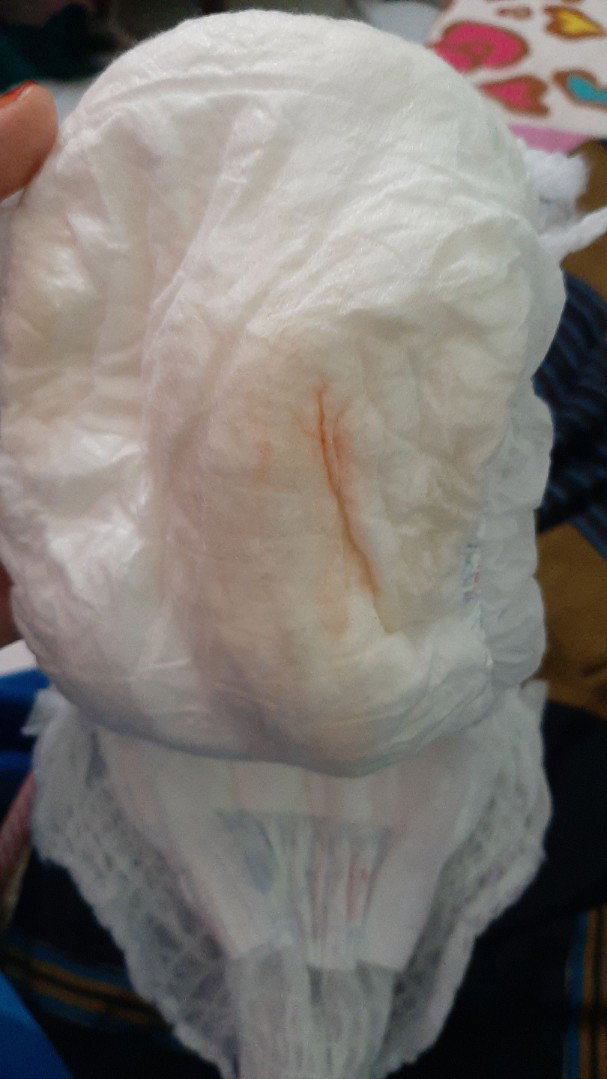 Bercak orange / pink di diapers