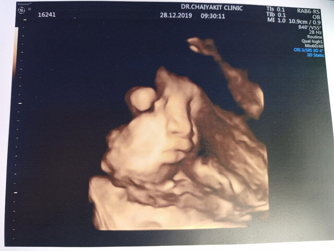 คลอดมาจะโด่งแบบนี้มัยลูกจมูกหนู