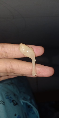 keputihan