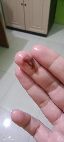 Flek di usia kehamilan 6w4d