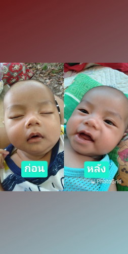 ฉีดวัคซีน2เดือนครับ
