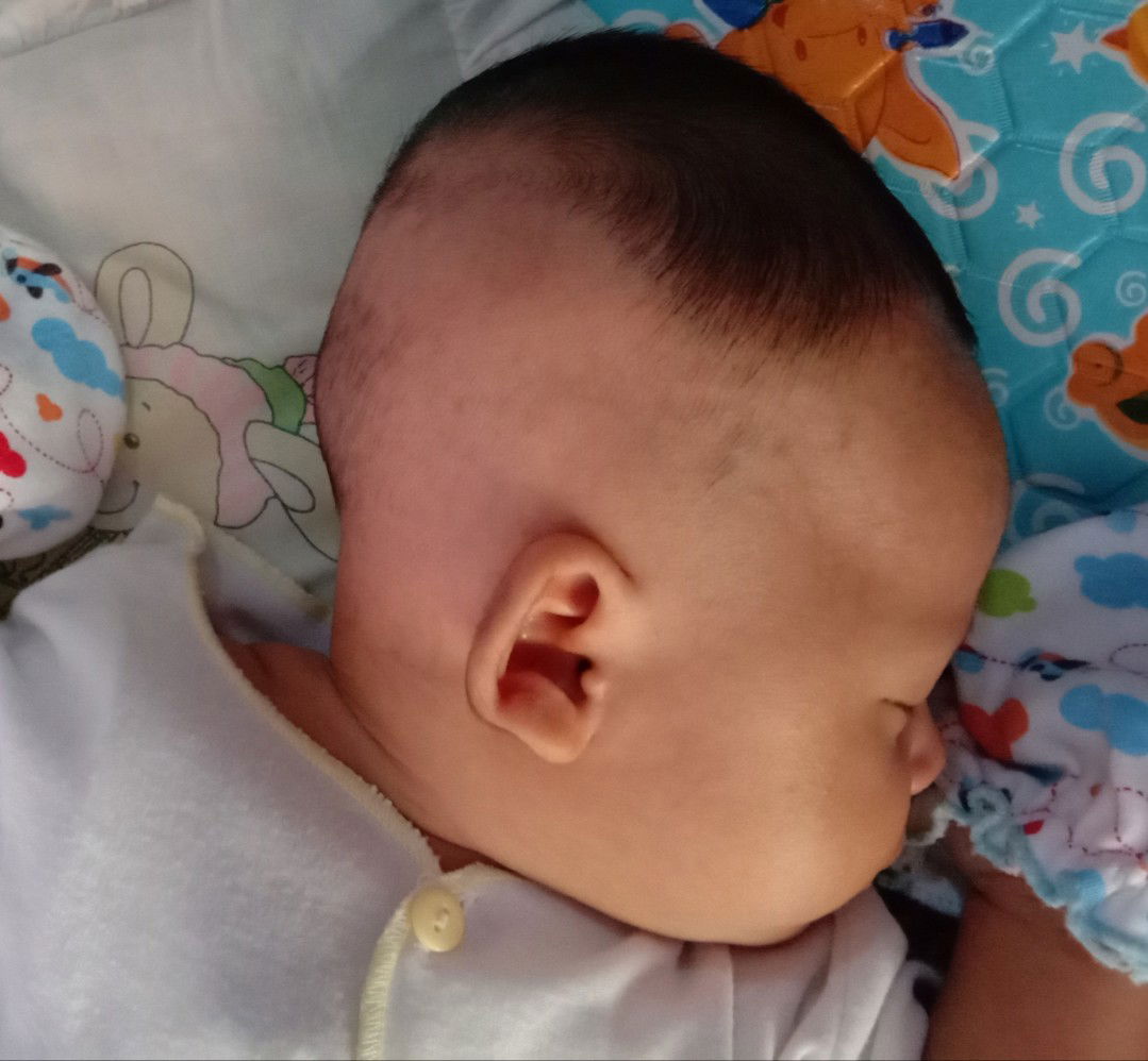 Kepala bayi