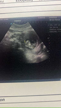 poppy ขนมหวาน'นน (이서윤) profile icon