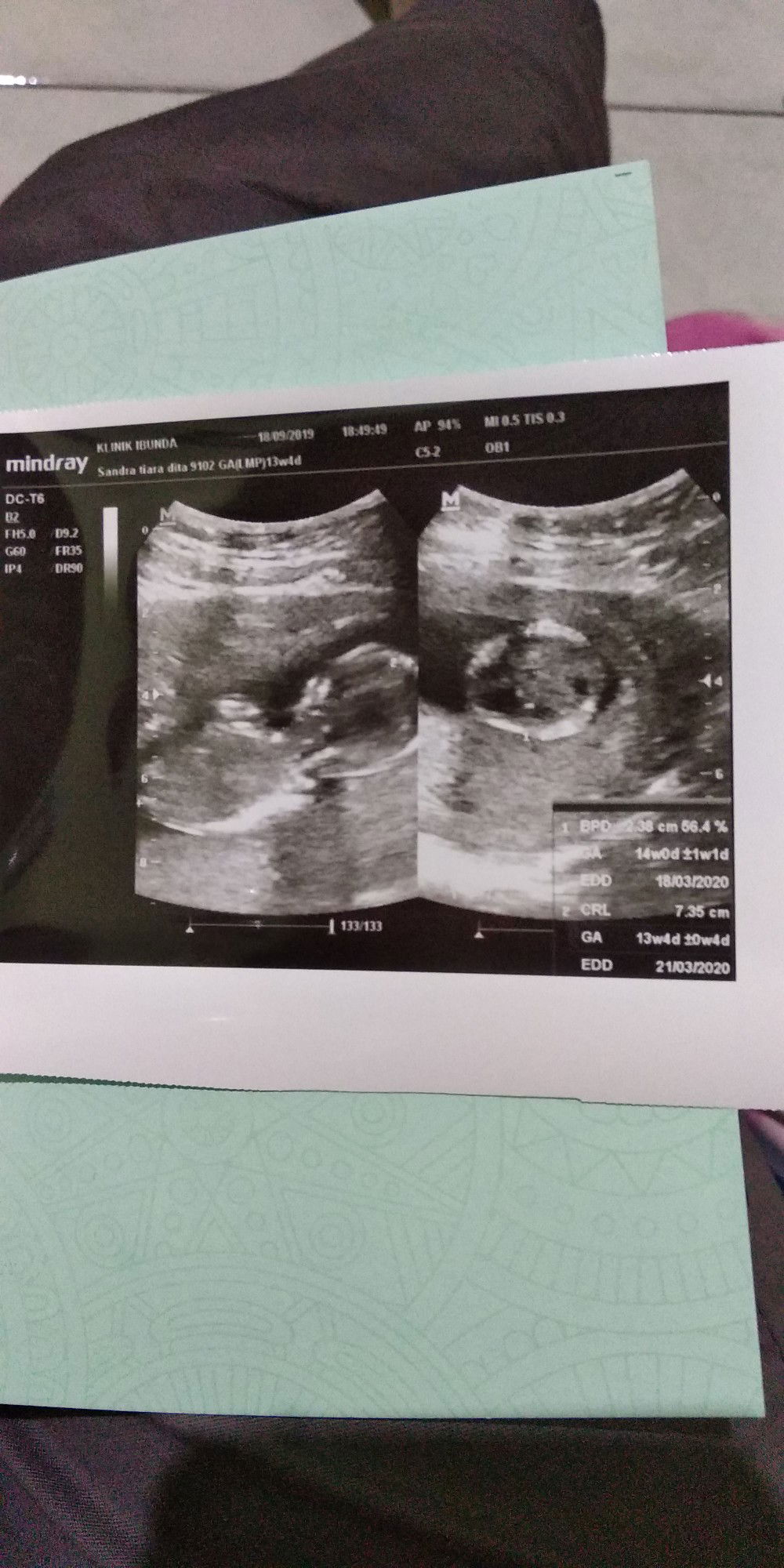 khawatir merawat bayi, minta saran