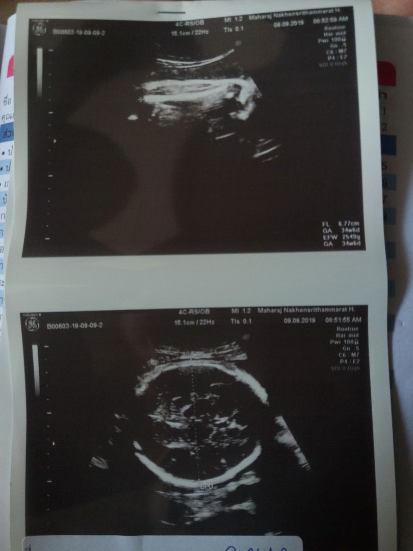 ความสุขของฉัน?