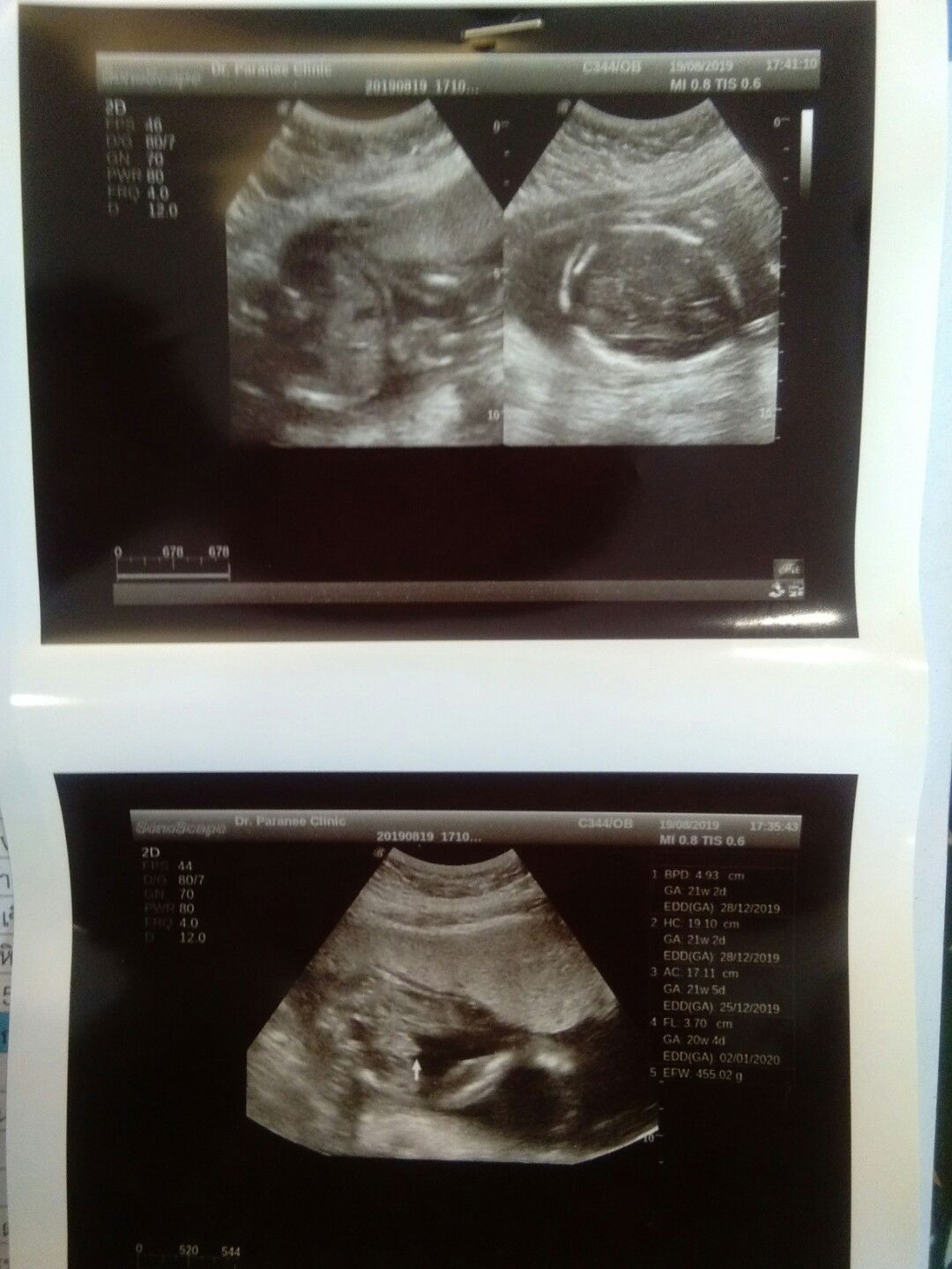 สอบถามค่ะ