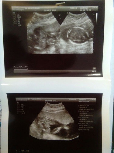 สอบถามค่ะ