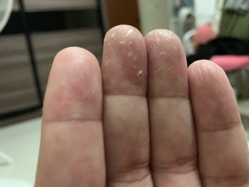 Super dry palm