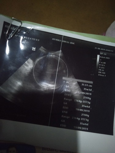 hasil usg