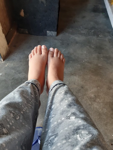 kaki bengkak