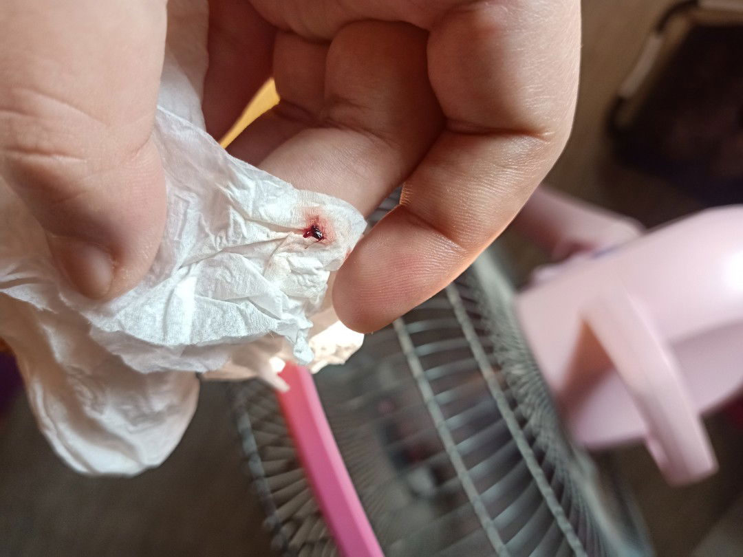 หลังจากที่โพสถามเรื่องมูกใส