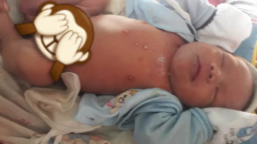 masalh kulit