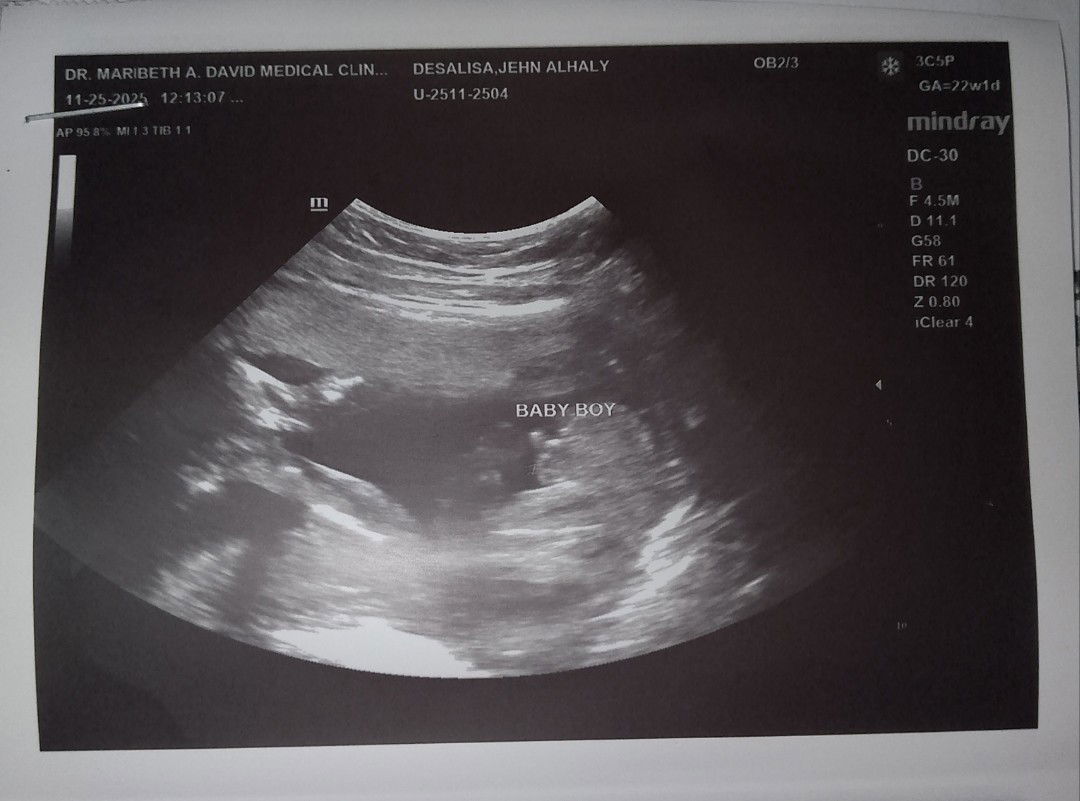 Jehn Desalisa profile icon