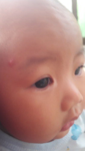 ตุ่ม