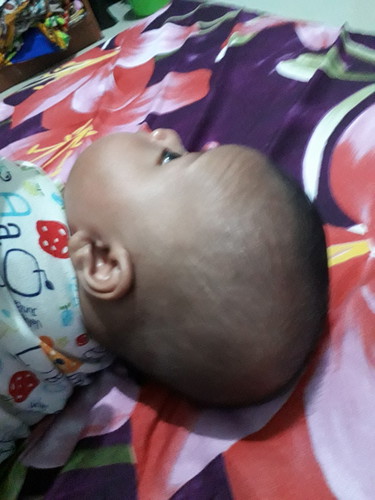 kepala bayi
