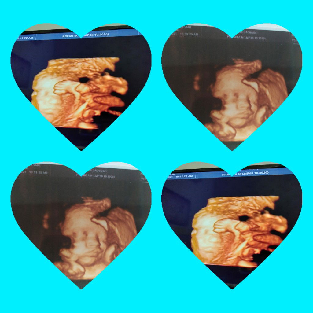 edelweis profile icon