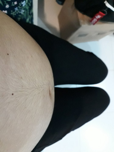 ตอนตั้งครรภ์มีขนขึ้นที่หน้าท้องไหมคะ?