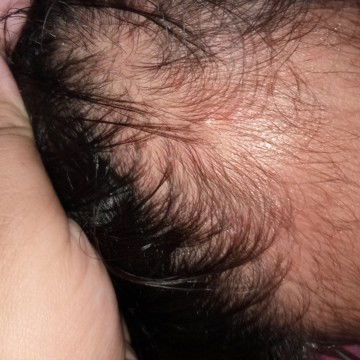 binti merah dikepala