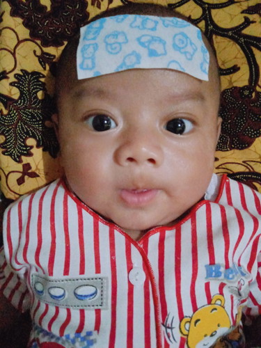 Demam pasca imunisasi