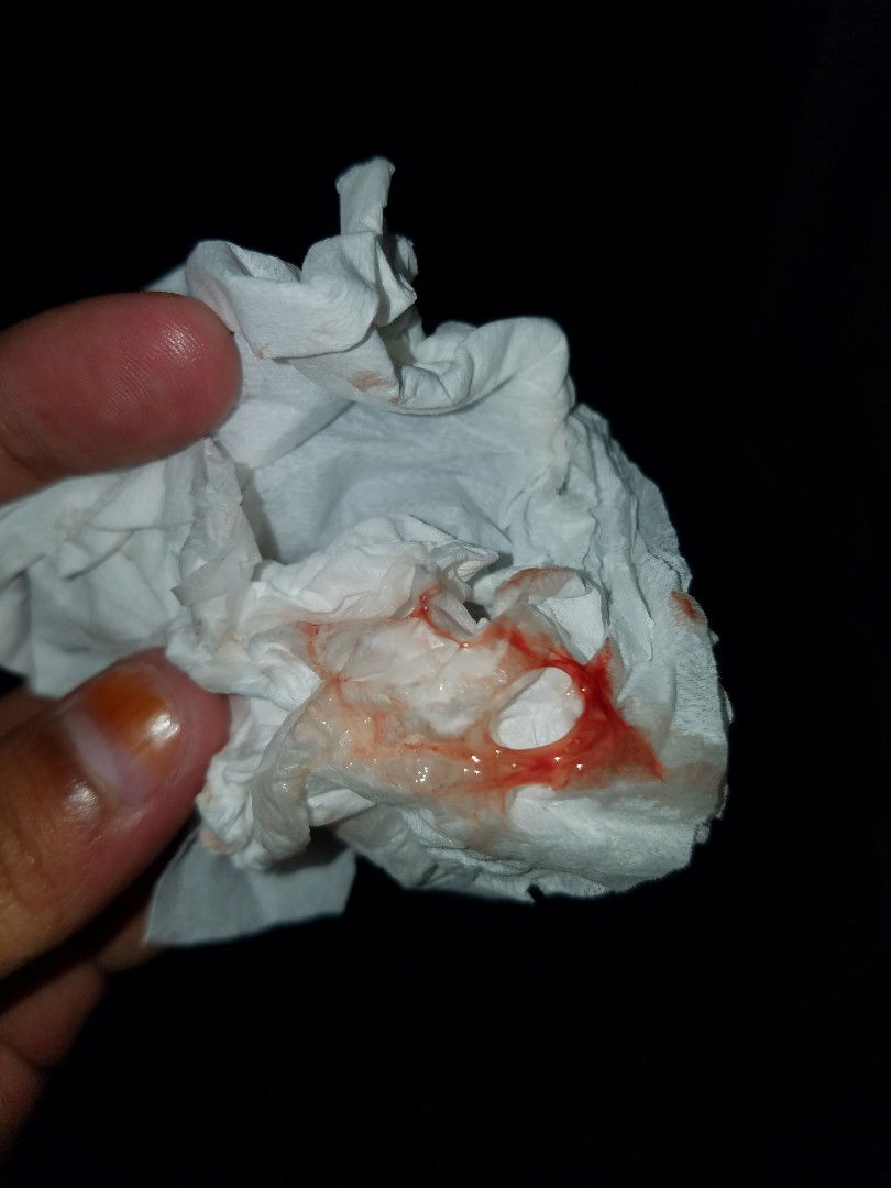 lendir bercampur darah ?