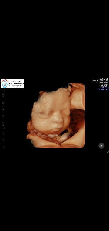 HPL Minggu, 24 November 2019