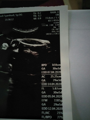 HPL nya yang mana yaa