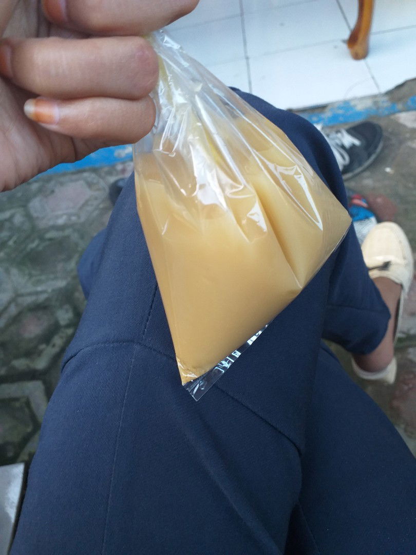 boleh tidak minum beras kencur ?