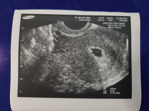 ปรึกษาปัญหาตั้งครรภ์