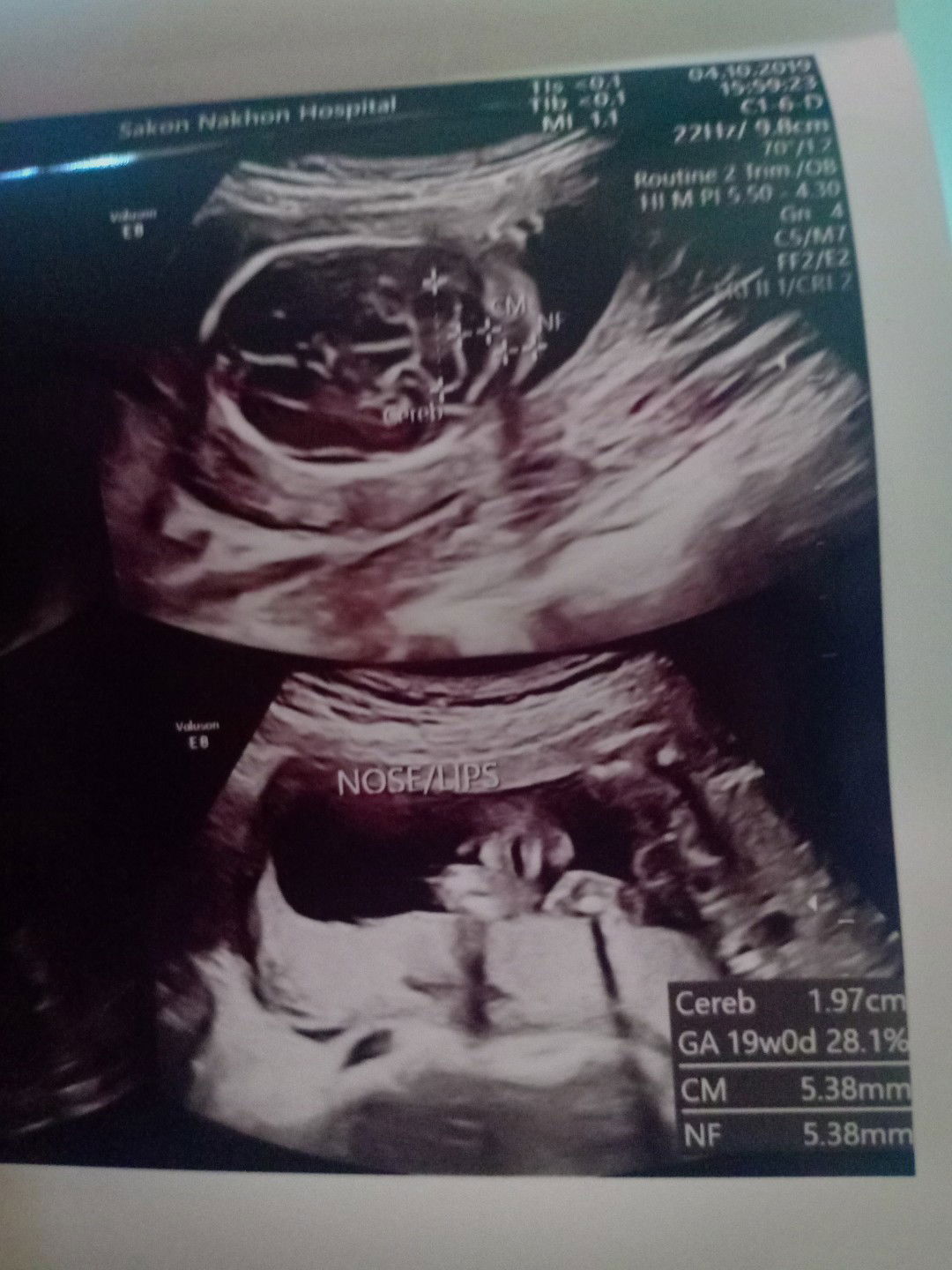 ขอกำลังใจ