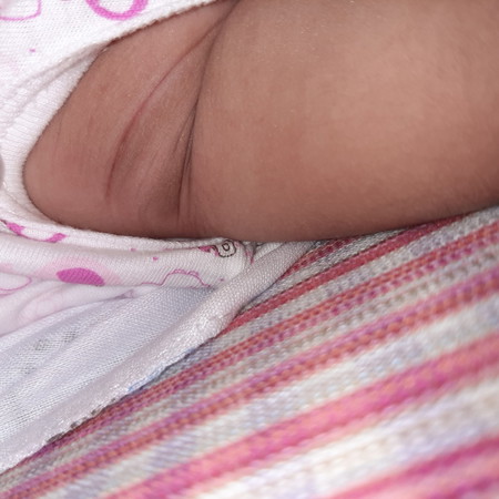 รักแร้ดำ