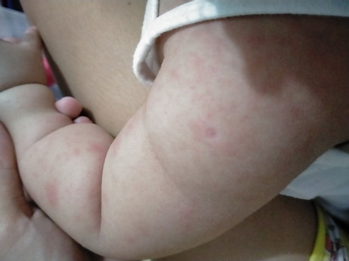 ano pong pdeng gawin?