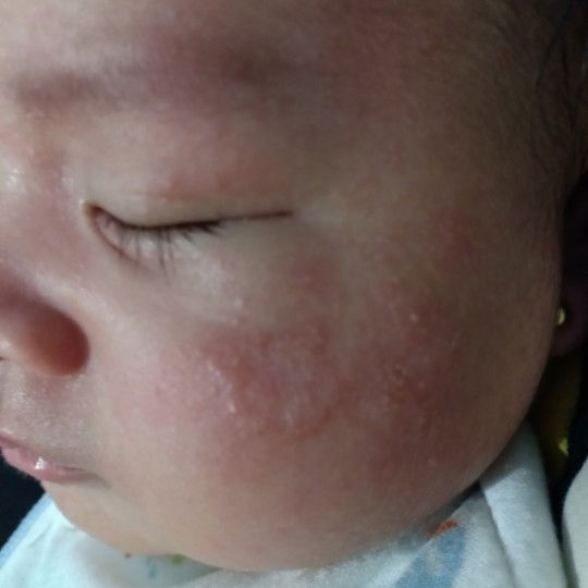 Katanya kena air susu