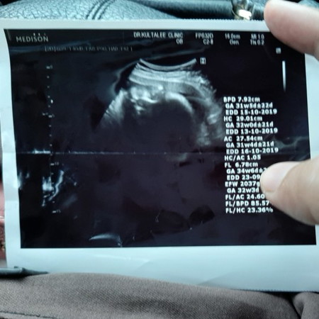 สาวน้อย