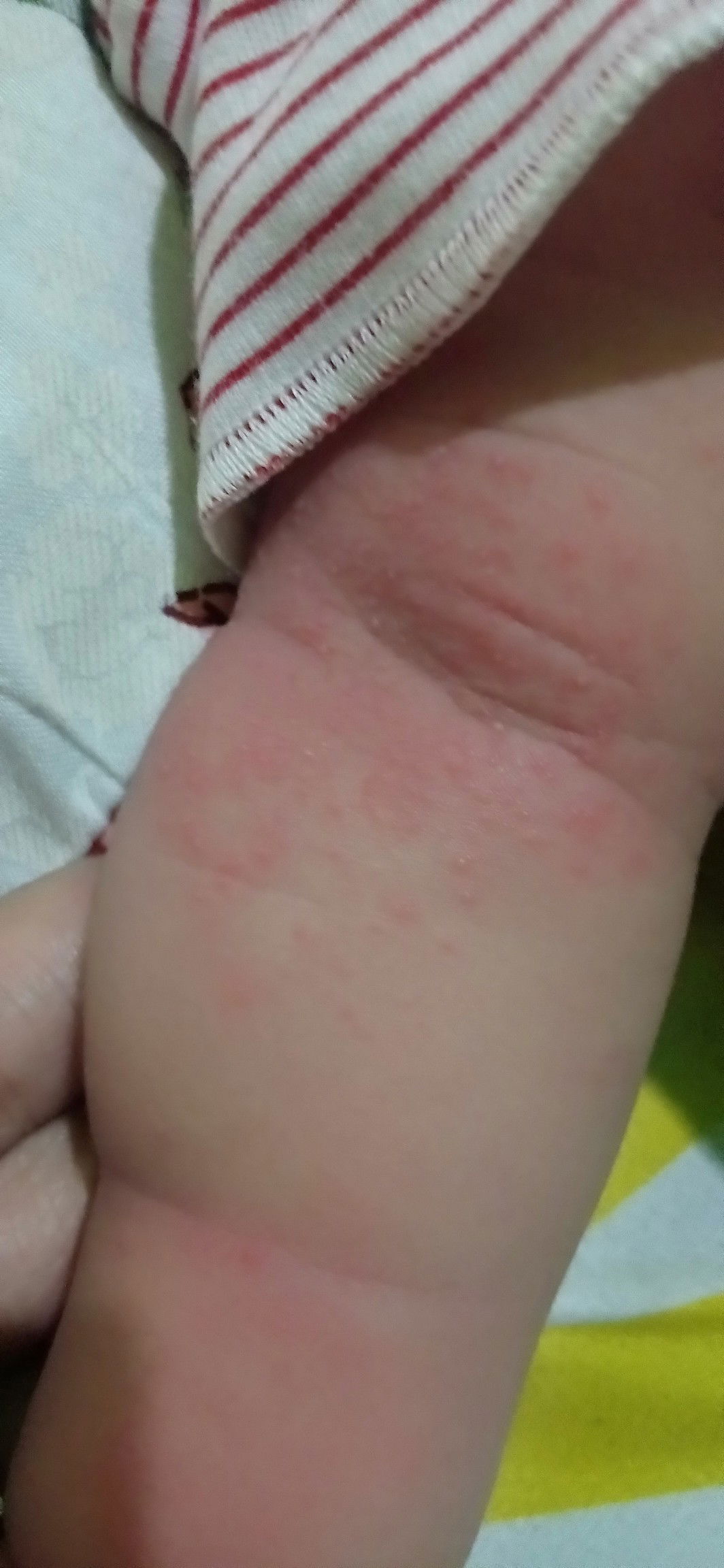 merah merah pada kulit