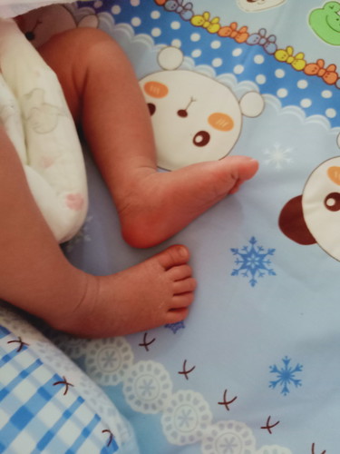 เท้าน้องปกติไหม?