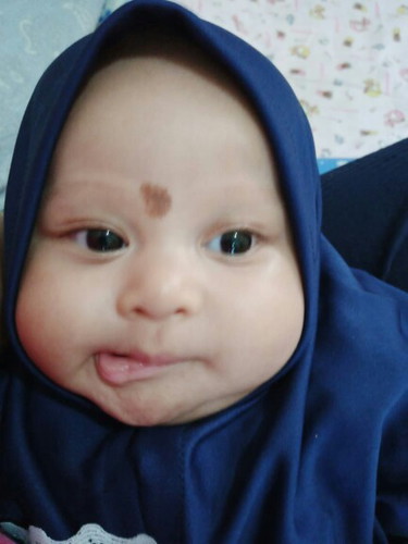 tanda lahir