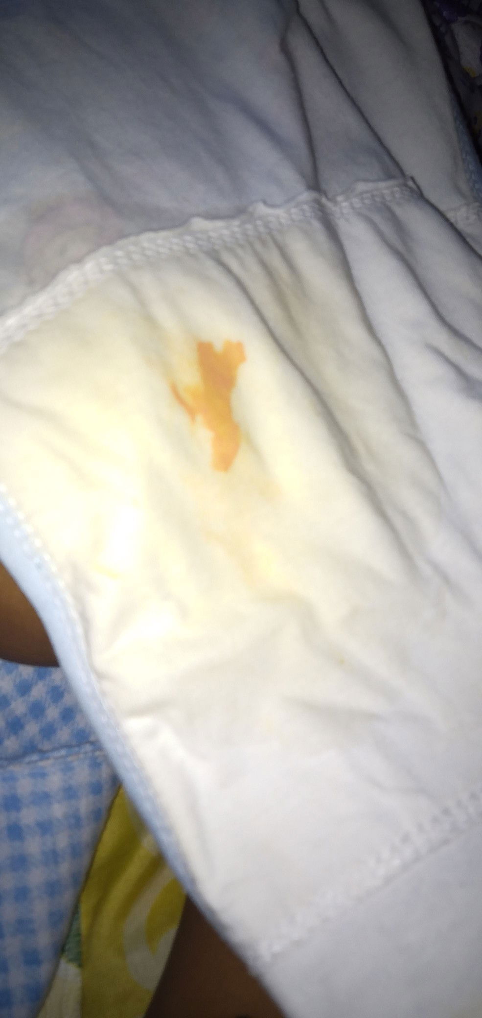 Bercak orange di popok