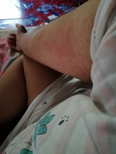 ใครเคยเปนบ้างค่ะ
