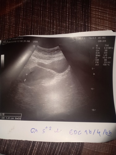 ตั้งครรภ์ 5 week