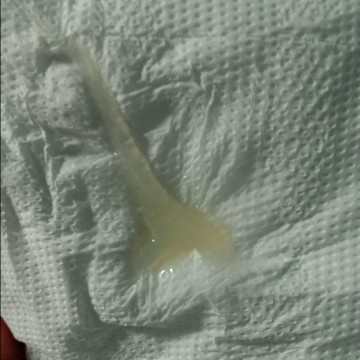 อันนี้ใช่มูกใสไหมค่ะ