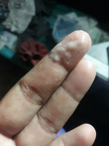 มีแบบนี้ออกมาคืออะไรค่ะ 39+2