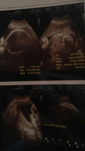 baby